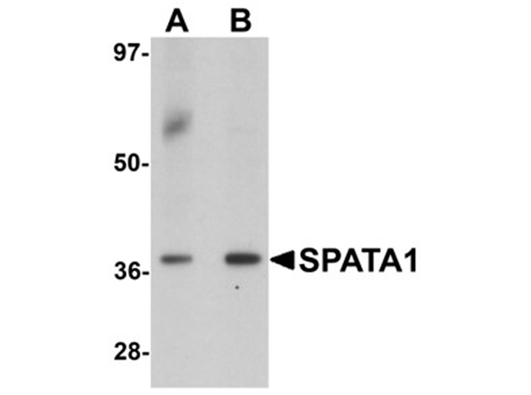 Western blot analysis of SPATA1