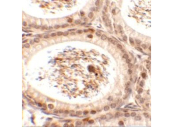 Immunohistochemistry of SPATA3
