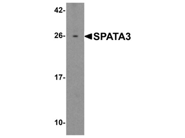 Western blot analysis of SPATA3