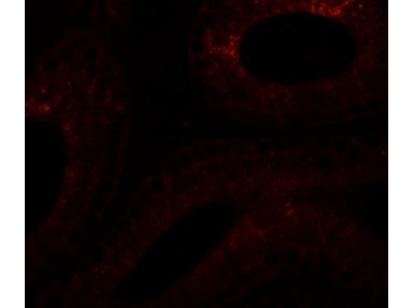 Immunofluorescence of SPATA6