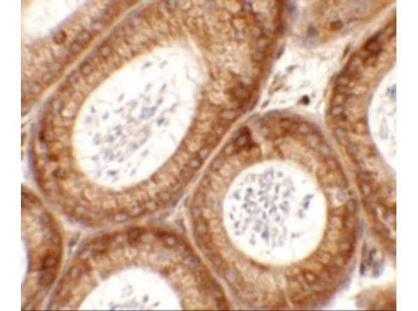 Immunohistochemistry of SPATA6