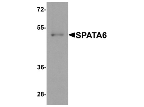 Western blot analysis of SPATA6