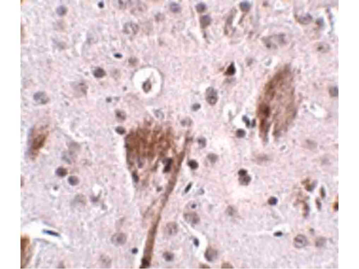 Immunohistochemistry of SPG11 Antibody