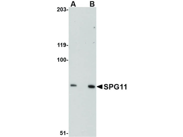 Western Blot of SPG11 Antibody