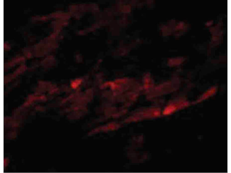 Immunofluorescence of SPG15 Antibody