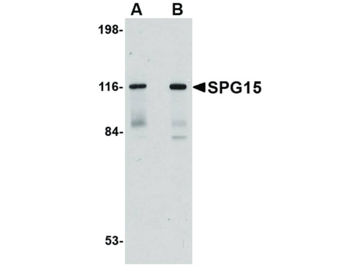 Western Blot of SPG15 Antibody
