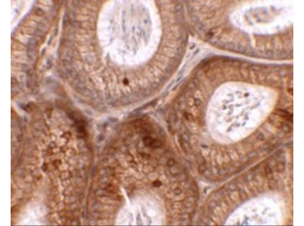 Immunohistochemistry of SPINK2