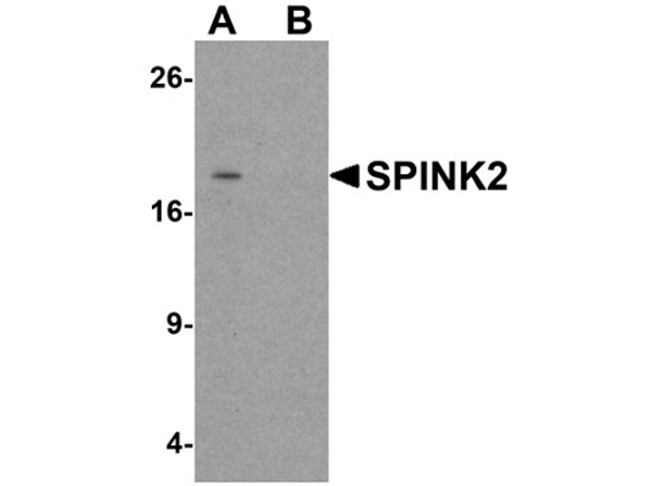 Western blot analysis of SPINK2