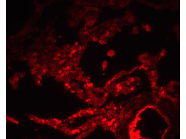 Immunofluorescence of SPINSTER
