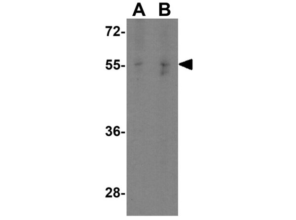 Western blot of SPINSTER