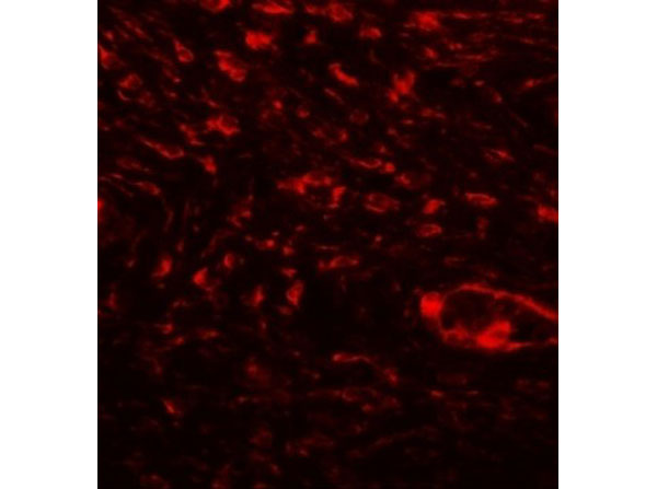 Immunofluorescence of SPP1