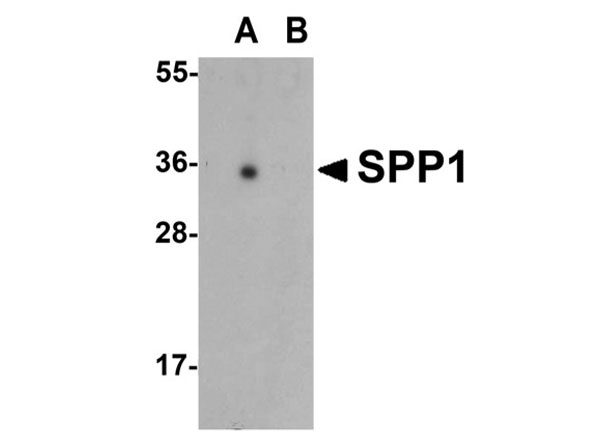 Western blot of SPP1
