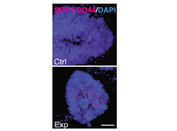 Immunofluorescence using SPP1