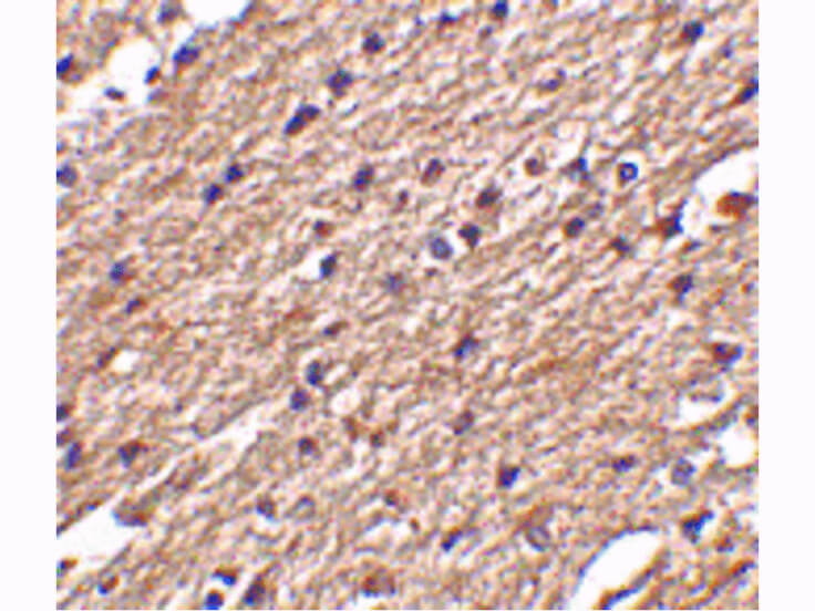 Immunohistochemistry of Spred3 Antibody