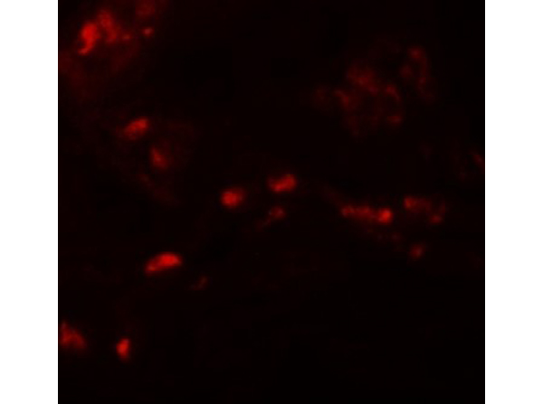 Immunofluorescence of SPRYD4