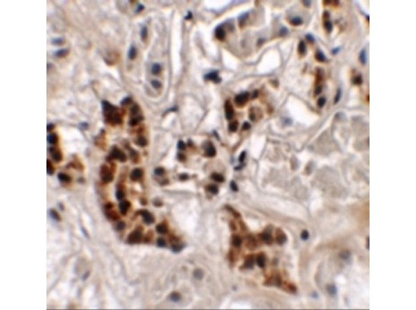 Immunohistochemistry of SPRYD4