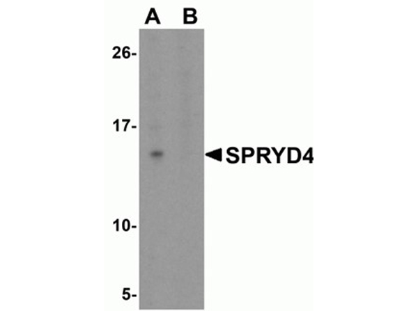 Western blot analysis of SPRYD4