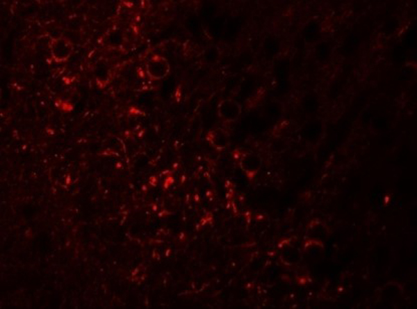 Immunofluorescence of SPRYD5