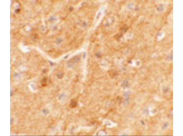Immunohistochemistry of SPRYD5