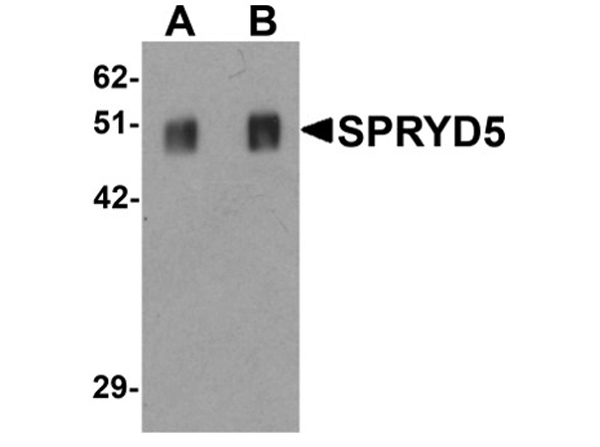 Western blot analysis of SPRYD5.