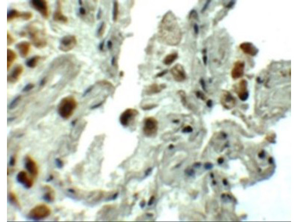 Immunohistochemistry of SPT1