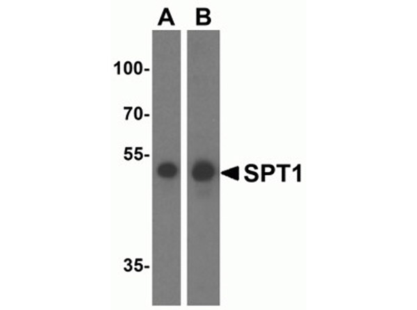 Western blot analysis of SPT1