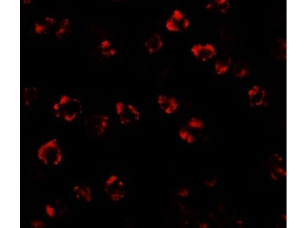 Immunofluorescence Validation of SPT2