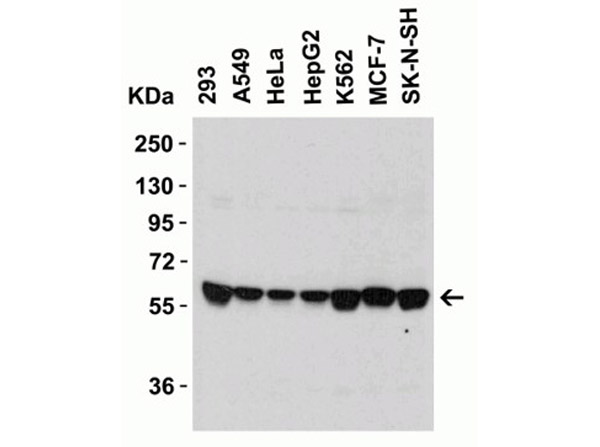 Western Blot Validation of SPT2