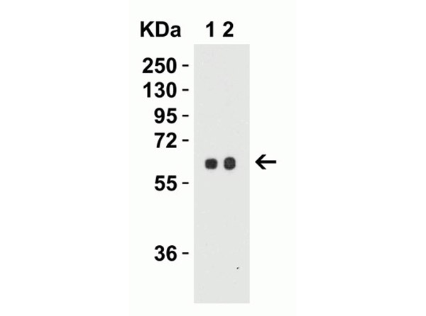 Western Blot Validation of SPT2.
