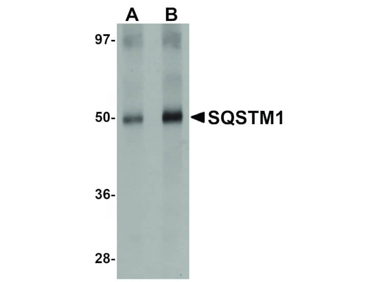 Western Blot of SQSTM1 Antibody
