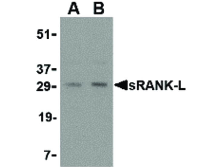 Western Blot of sRANK Ligand Antibody