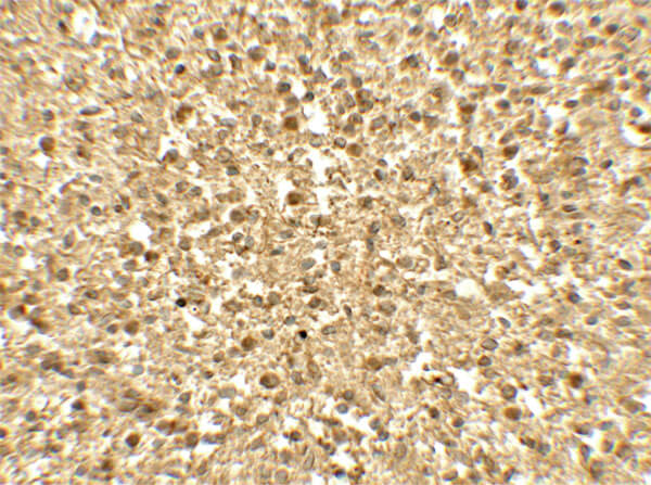 Immunohistochemistry of SREBF1 Antibody