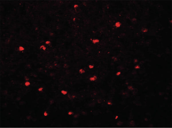 Immunofluorescence of SREBF2 Antibody