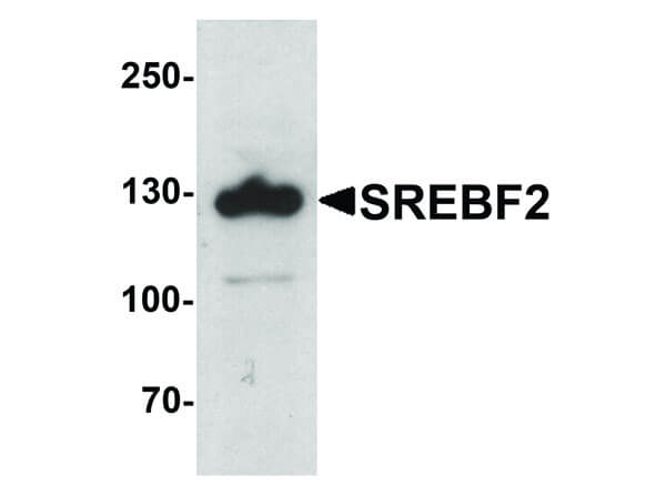 Western Blot of SREBF2 Antibody