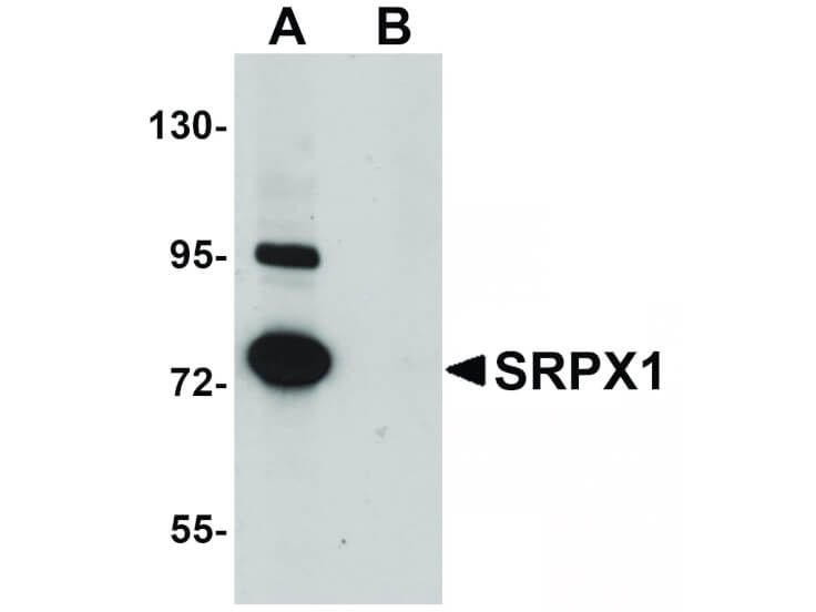Western Blot of SRPX1 Antibody