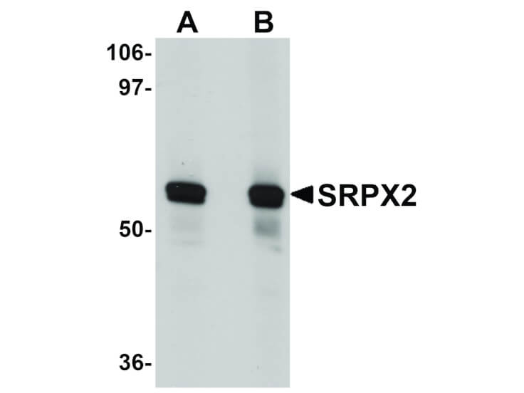 Western Blot of SRPX2 Antibody