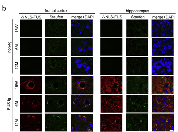 Immunofluorescence using STAU1