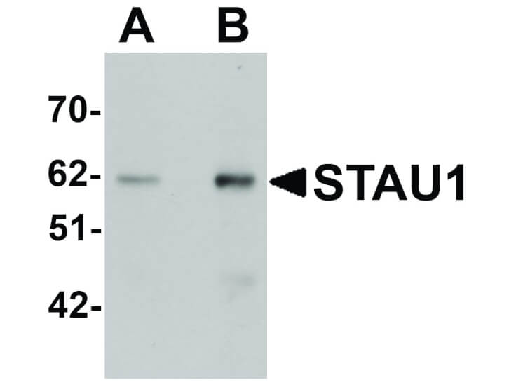 Western Blot of STAU1 Antibody