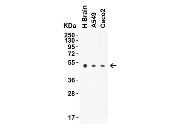 Western Blot of STEAP1