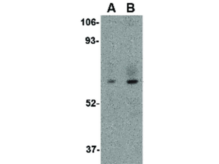 Western Blot of STEAP1 Antibody