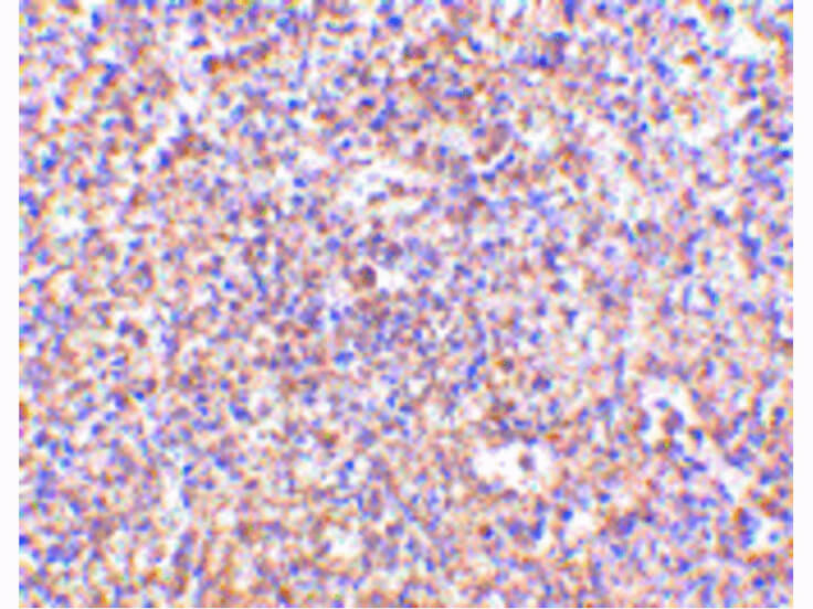 Immunohistochemistry of STEAP1 Antibody