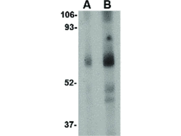 Western Blot of STEAP1 Antibody