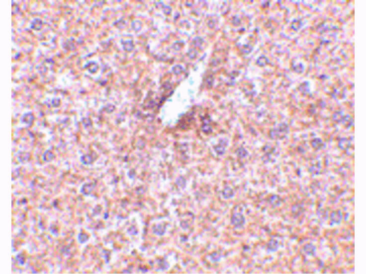 Immunohistochemistry of STEAP3 Antibody