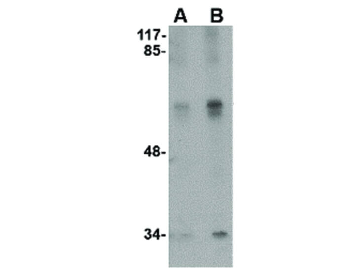 Western Blot of Stk39 Antibody