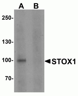 Western blot analysis of STOX1