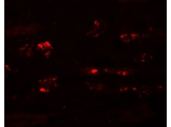 Immunofluorescence of STOX2