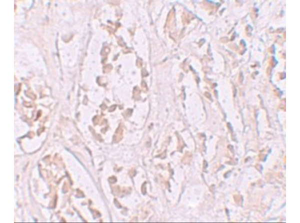 Immunohistochemistry of STOX2