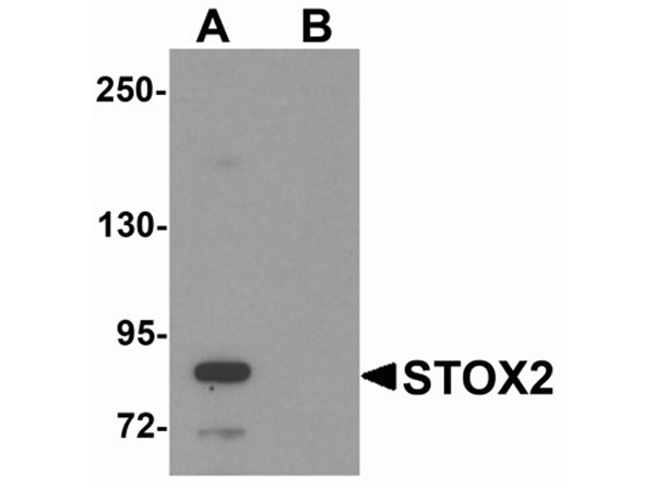 Western blot of STOX2