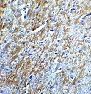 Immunohistochemistry of Survivin