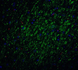 Immunocytochemistry using Survivin